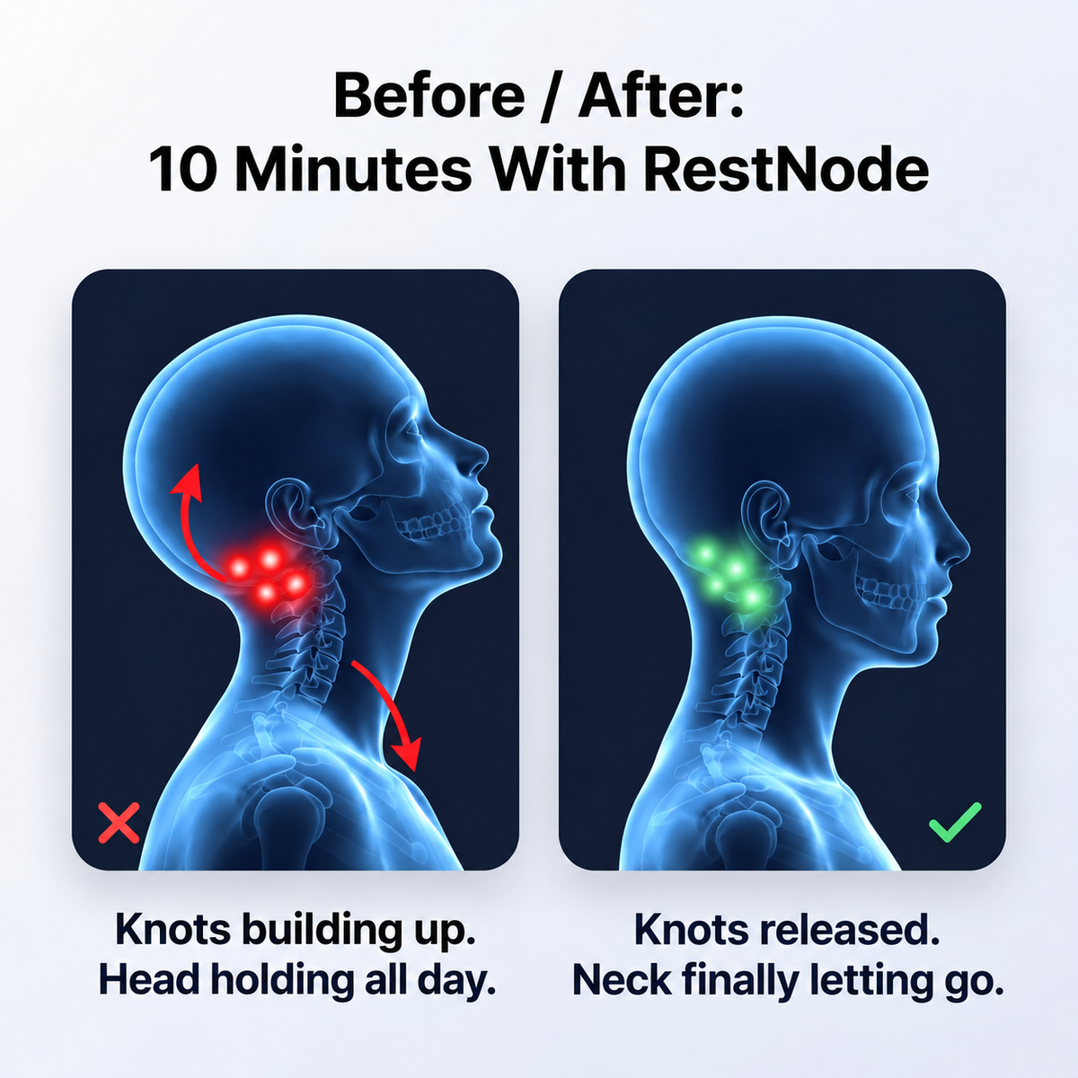 Lune™ RestNode