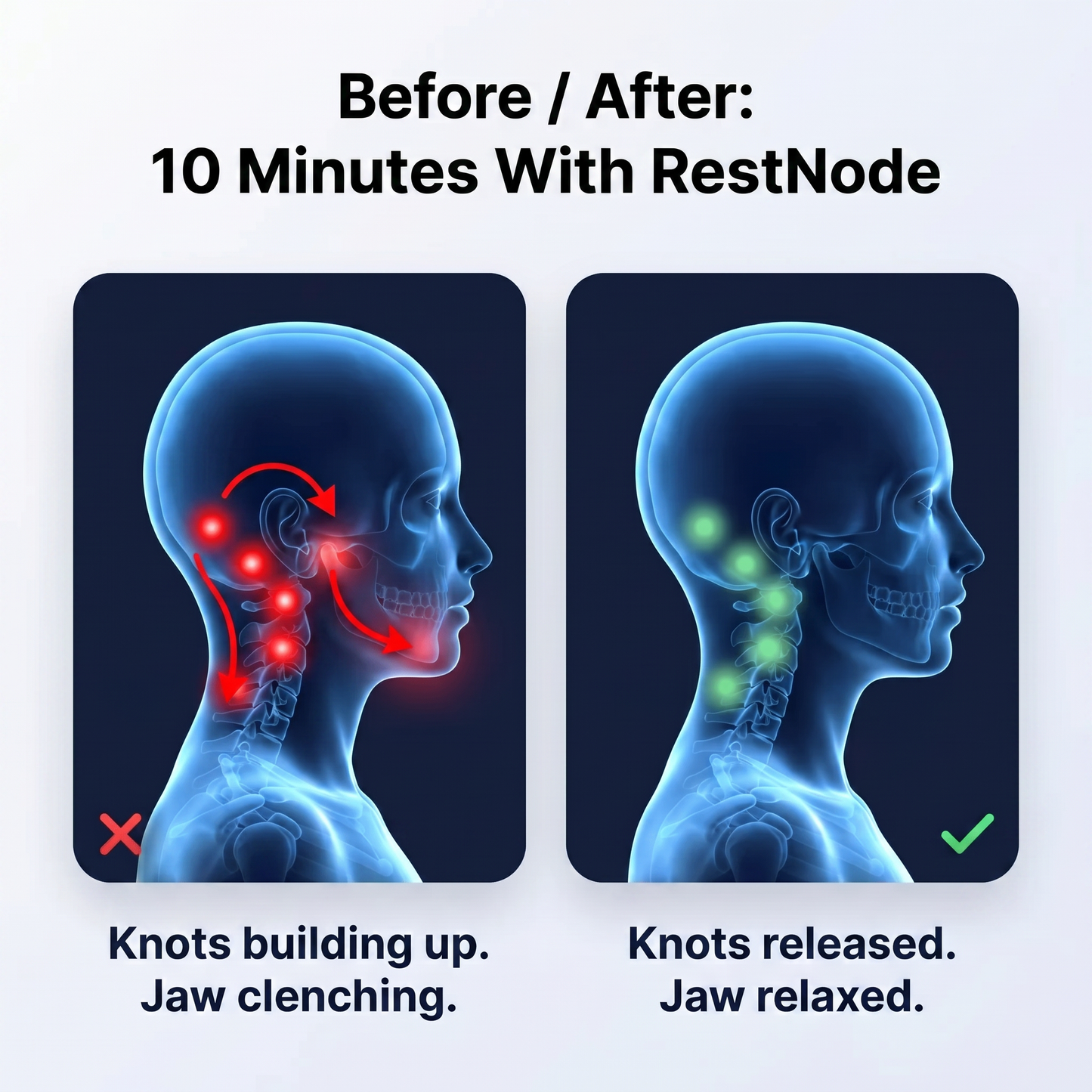 Lune™ RestNode